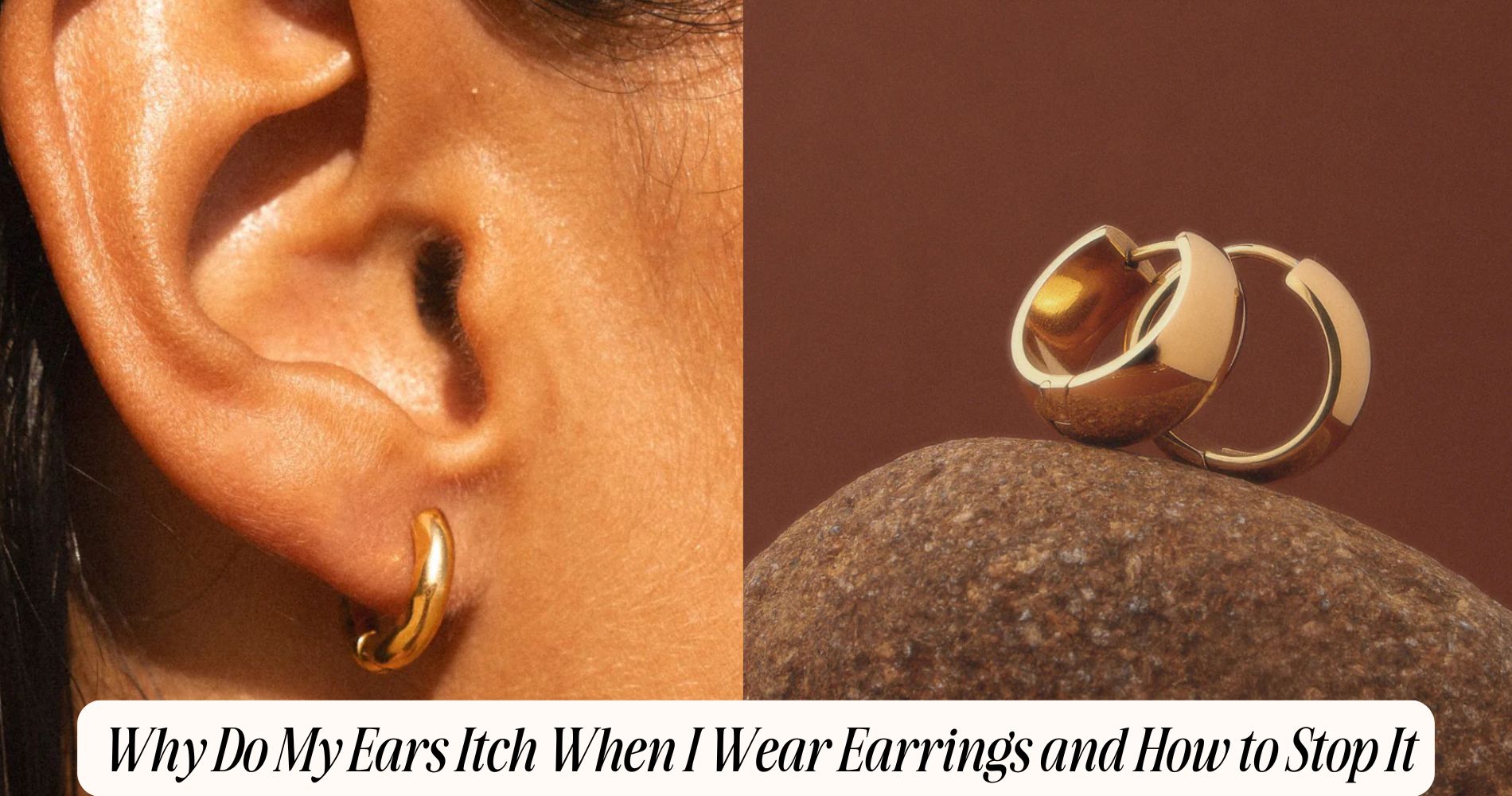 why do my ears itch when i wear earrings