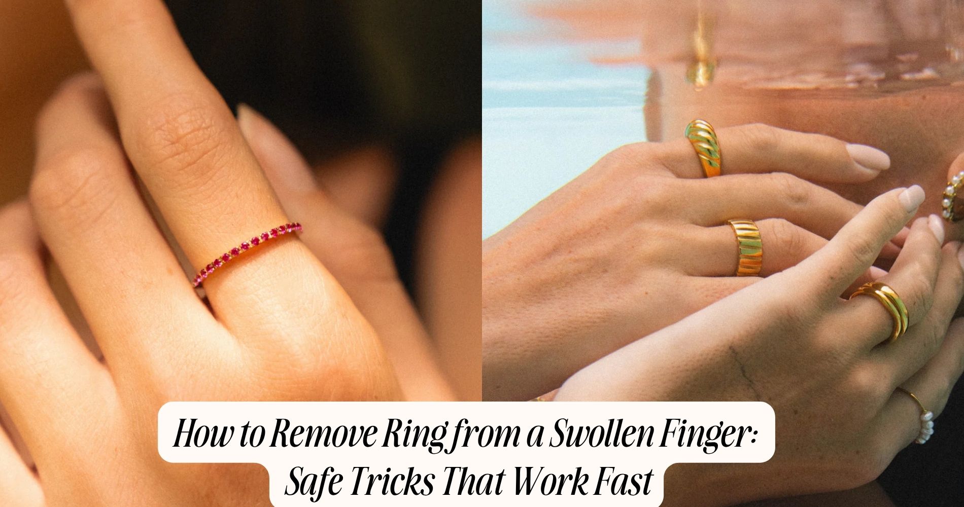 how to remove ring from a swollen finger