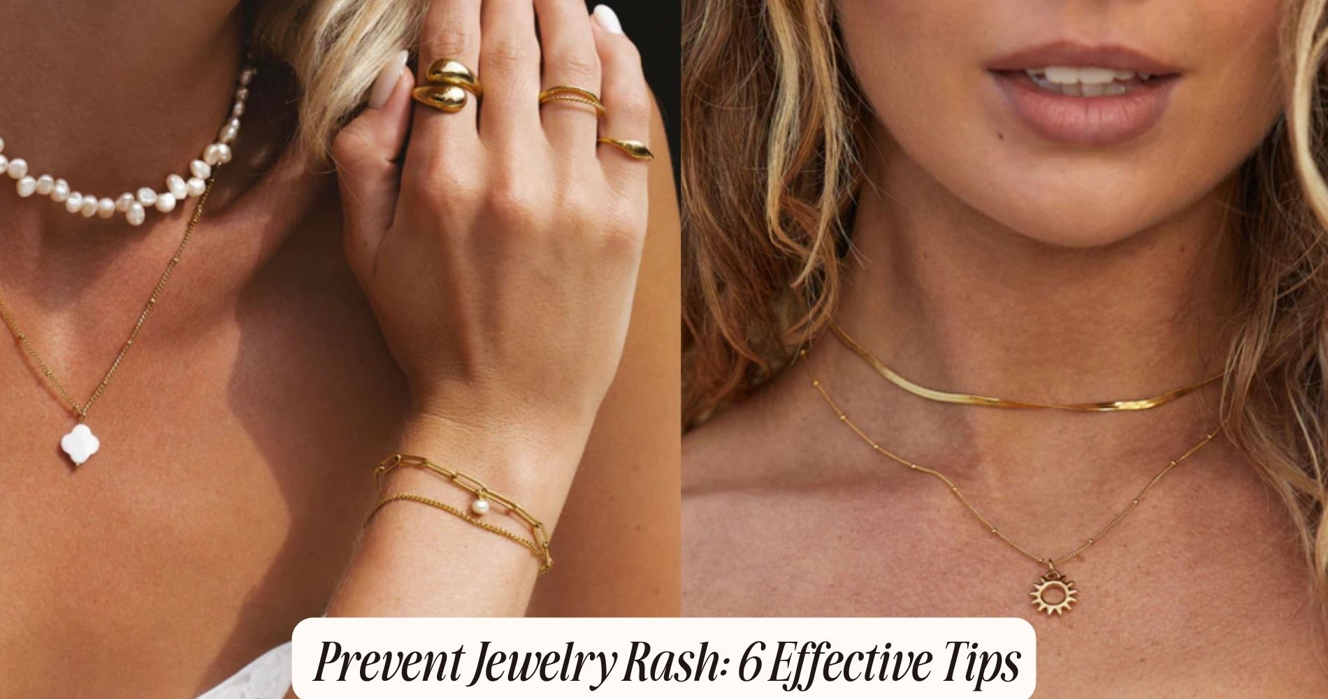 how to prevent jewelry rash