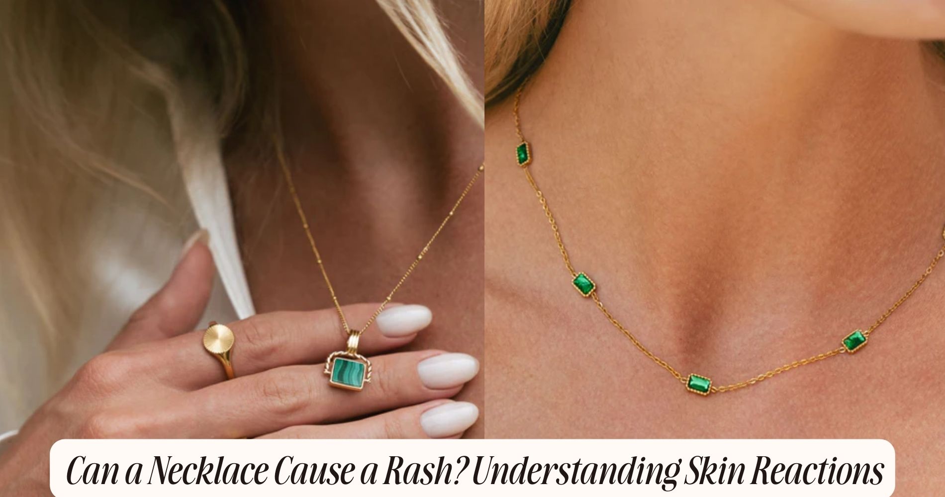 can a necklace cause a rash