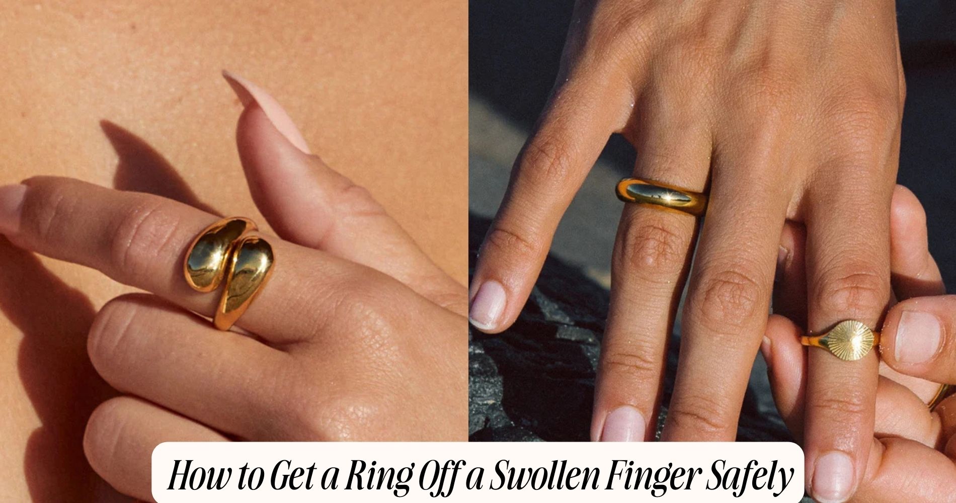 how get a ring off a swollen finger​