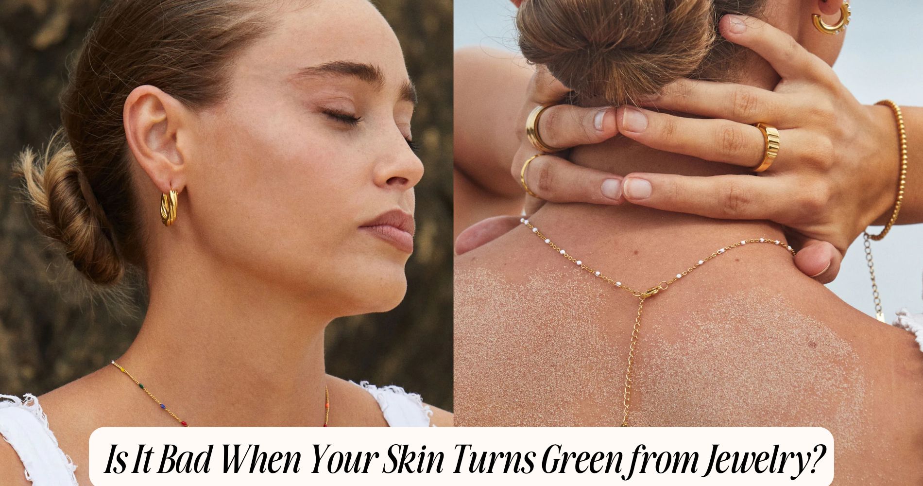 is it bad when your skin turns green from jewelry​